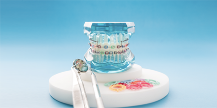 The Rise of In-house Orthodontics